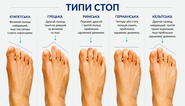 Формы стоп