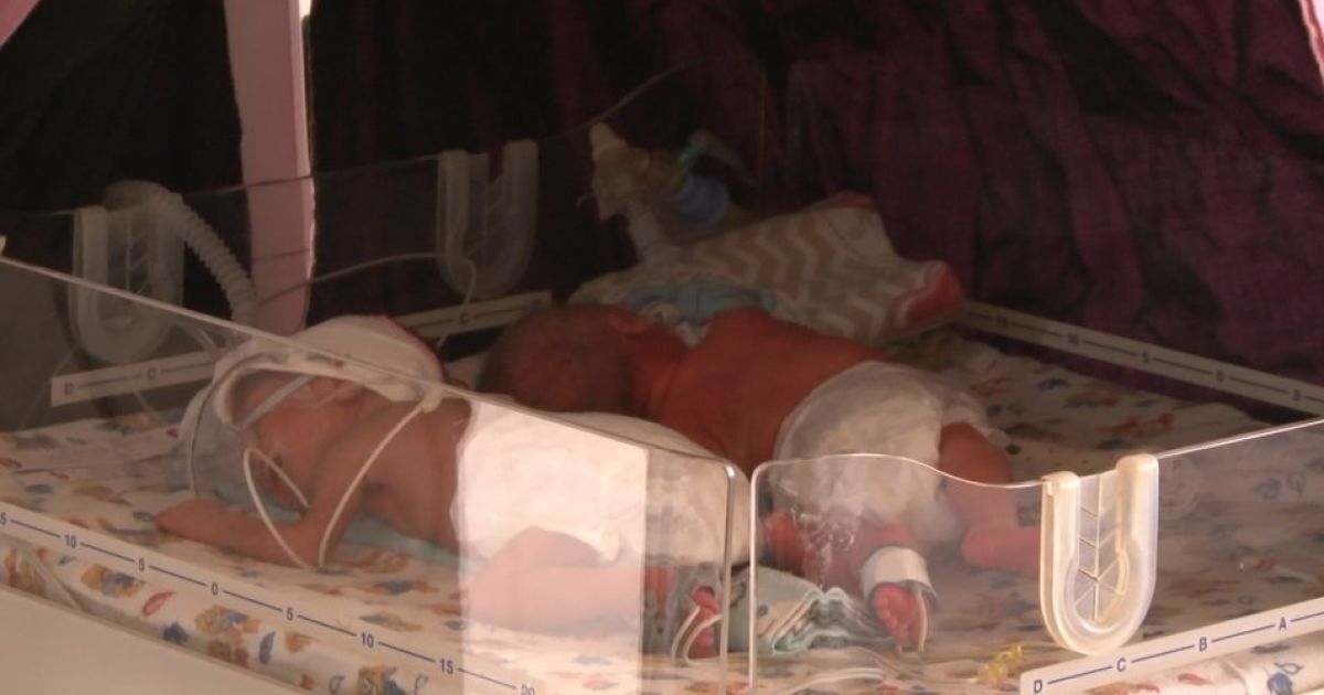 Унікальній четверні із Закарпаття дали імена: як почуваються діти
