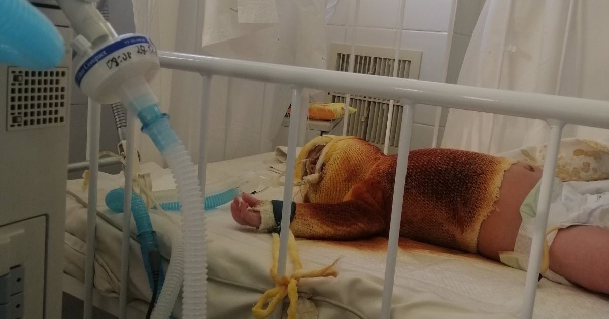 Термінової допомоги потребує 3-місячний Русланчик