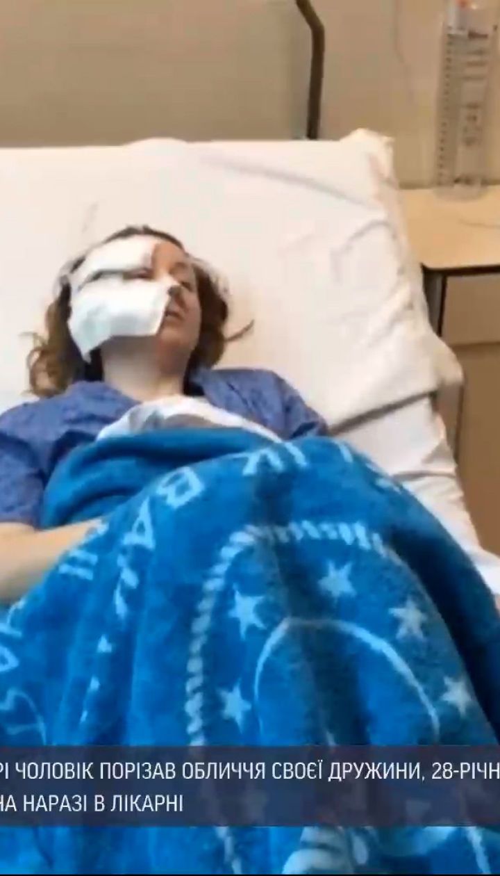 В Стамбуле мужчина из ревности порезал ножом лицо 28-летней жены-украинки