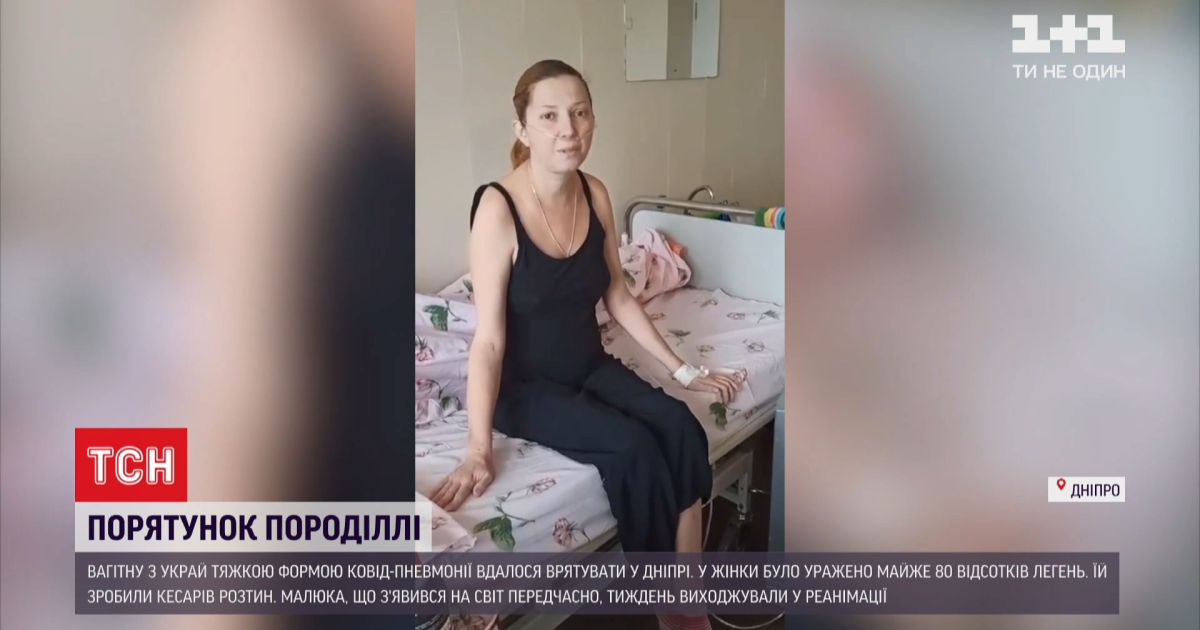 "Дитина задихалася в утробі": у Дніпрі врятували породіллю, легені якої майже повністю уразив COVID-19