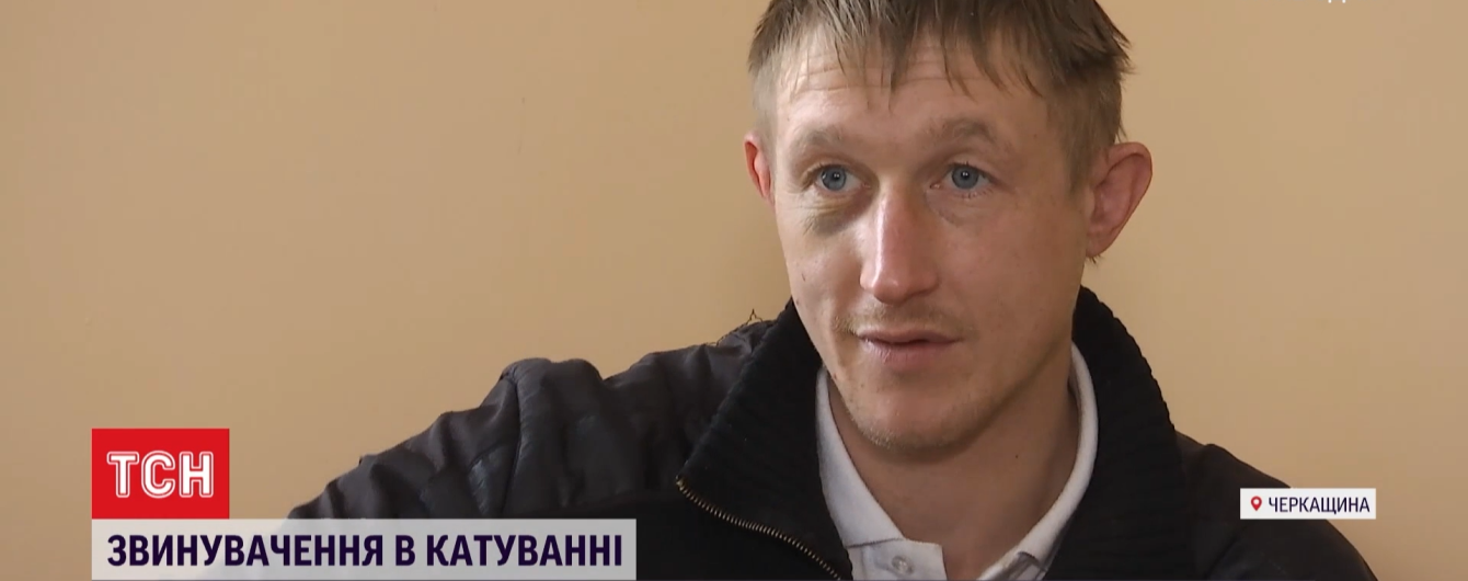Пытки правоохранителями в Городище: мужчине после избиения предлагали деньги, чтобы молчал