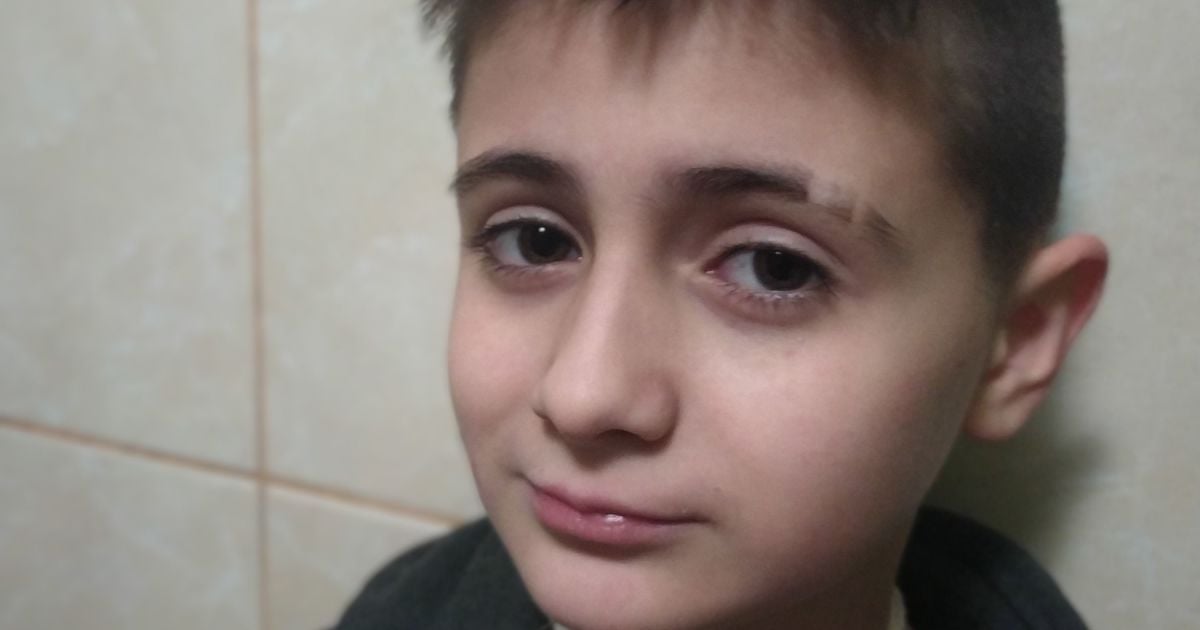 10 лет Никита живет с трубочками в горле и животе, сейчас появился шанс это исправить