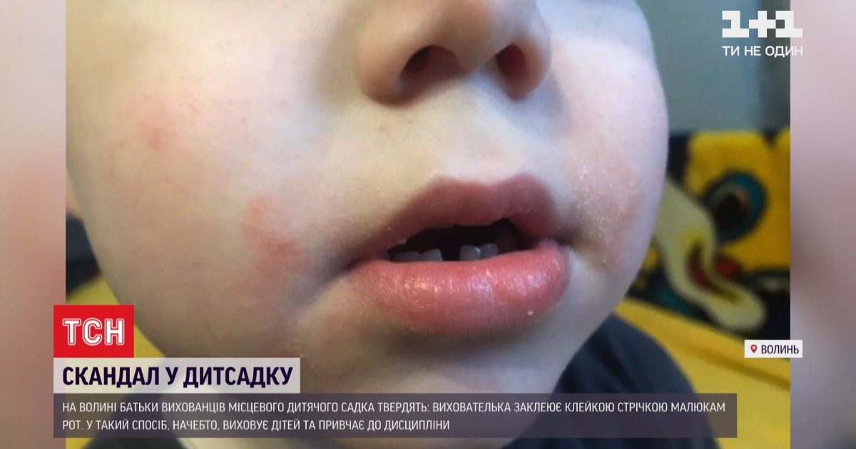 Не клеила, а пугала: воспитательница детсада уверяет, что скотч к детям не применяла