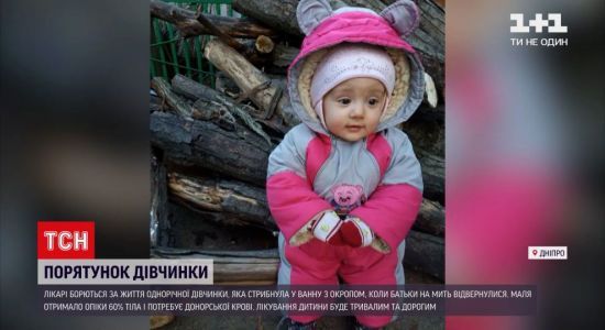 Медикаментозний сон та 60% опіків шкіри: у Дніпрі медики рятують однорічну дівчинка