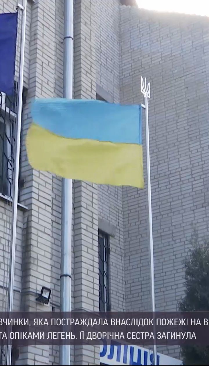 Новини України: дівчинка, яка постраждала від пожежі у Вінницькій області, перебуває у медикаментозній комі