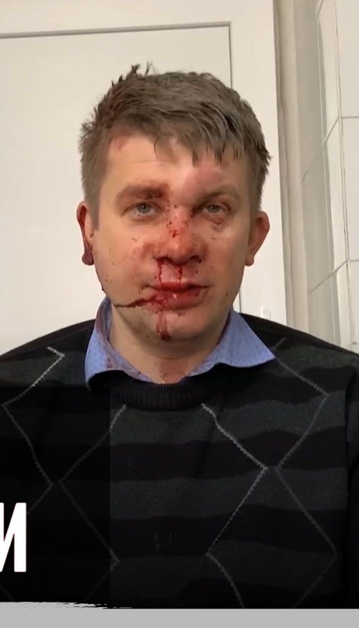 У Запоріжжі побили депутата обласної Ради Дмитра Майстра – "Секретні матеріали"