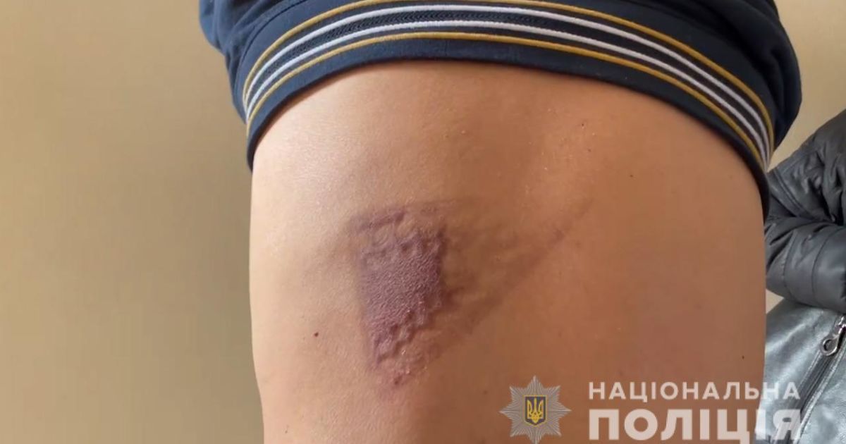 Викрадення та катування іноземців в Одеській області замовила цивільна дружина однієї із жертв