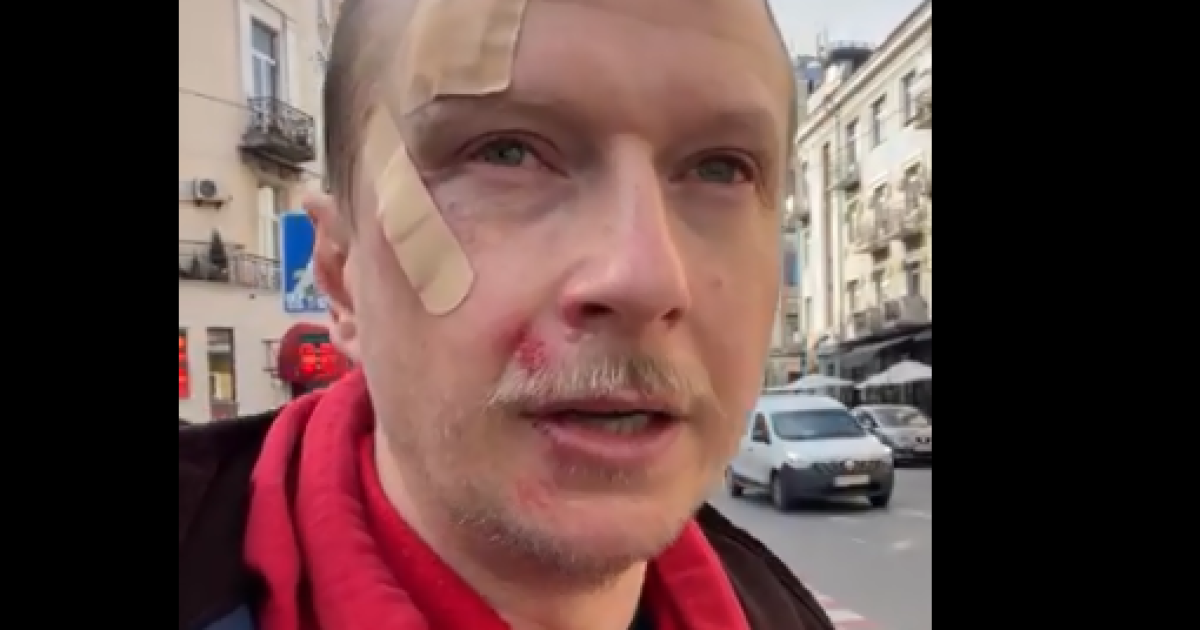 У центрі Києва через зауваження побили відомого ведучого Майкла Щура