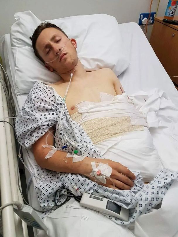 Хірурги пришили руку пожежника всередину живота, щоб врятувати її / © SWNS