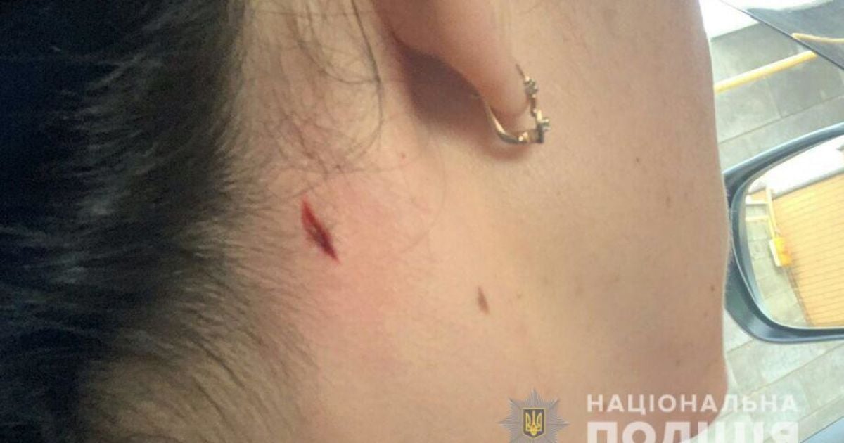 Женщина в Николаеве во время стрельб полицейских получила ранение в шею