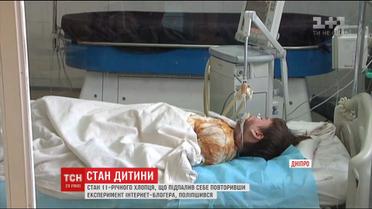 Состояние юноши, который поджег себя накануне, улучшилось