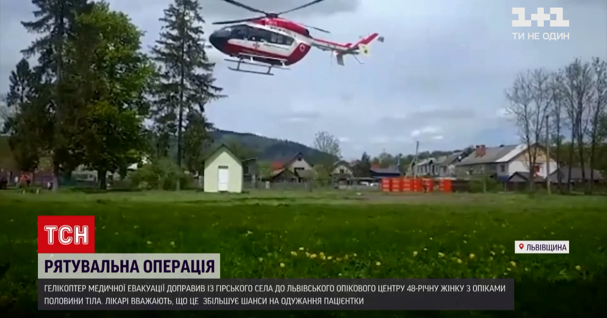 Во Львовской области женщину с сильными ожогами госпитализировали в больницу вертолетом: видео