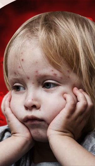 В садиках и школах Киева за год стало вдвое меньше непривитых детей