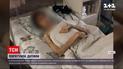 Новости Украины: в Одессе отец "духовно лечил" сына, а после подростка госпитализировали с анорексией