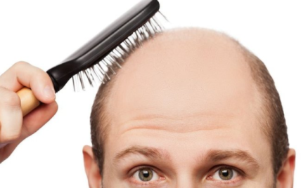 MINOX: Лечебная косметика от выпадения и  для роста волос