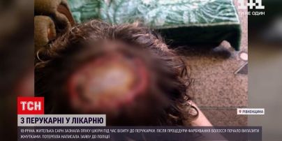 Новости Украины: в Ровенской области девушка осталась почти без волос после похода к парикмахеру
