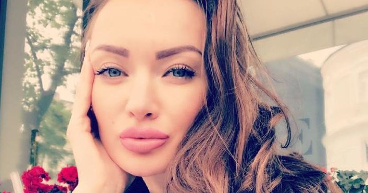 Із поламаною ногою і рукою. Целовальникова вперше прокоментувала свій стан після вибуху біля Бесарабки