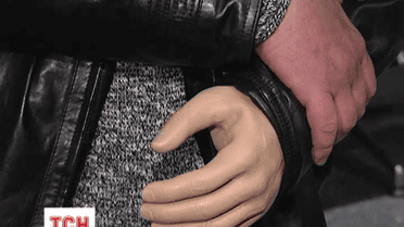 Из Германии вернулся боец 25 бригады Дмитрий Коваленко, там ему установили миопротез