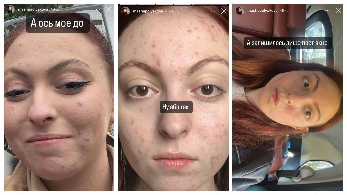 Маша Полякова / © instagram.com/mashapolyakova