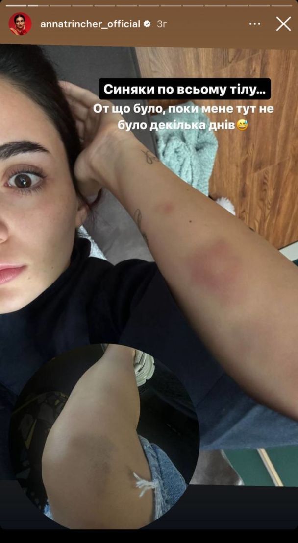 Анна Тринчер / © instagram.com/annatrincher_official