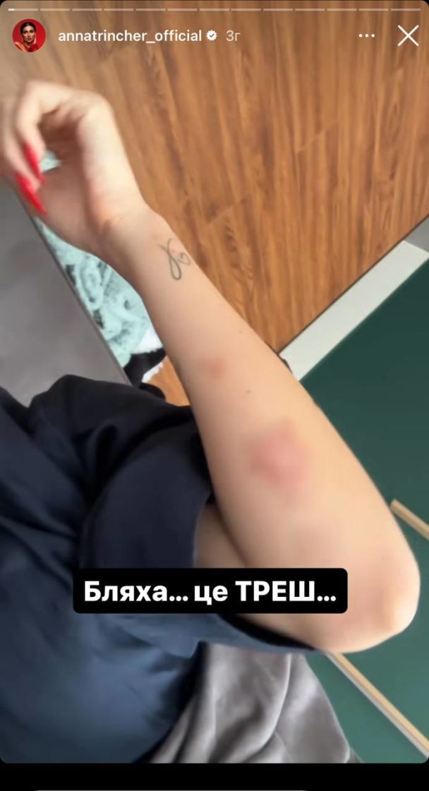 Анна Тринчер / © instagram.com/annatrincher_official