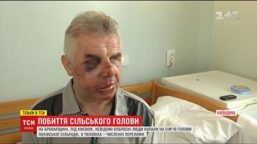 Під Києвом невідомі 2 години знущалися з сім'ї сільського голови