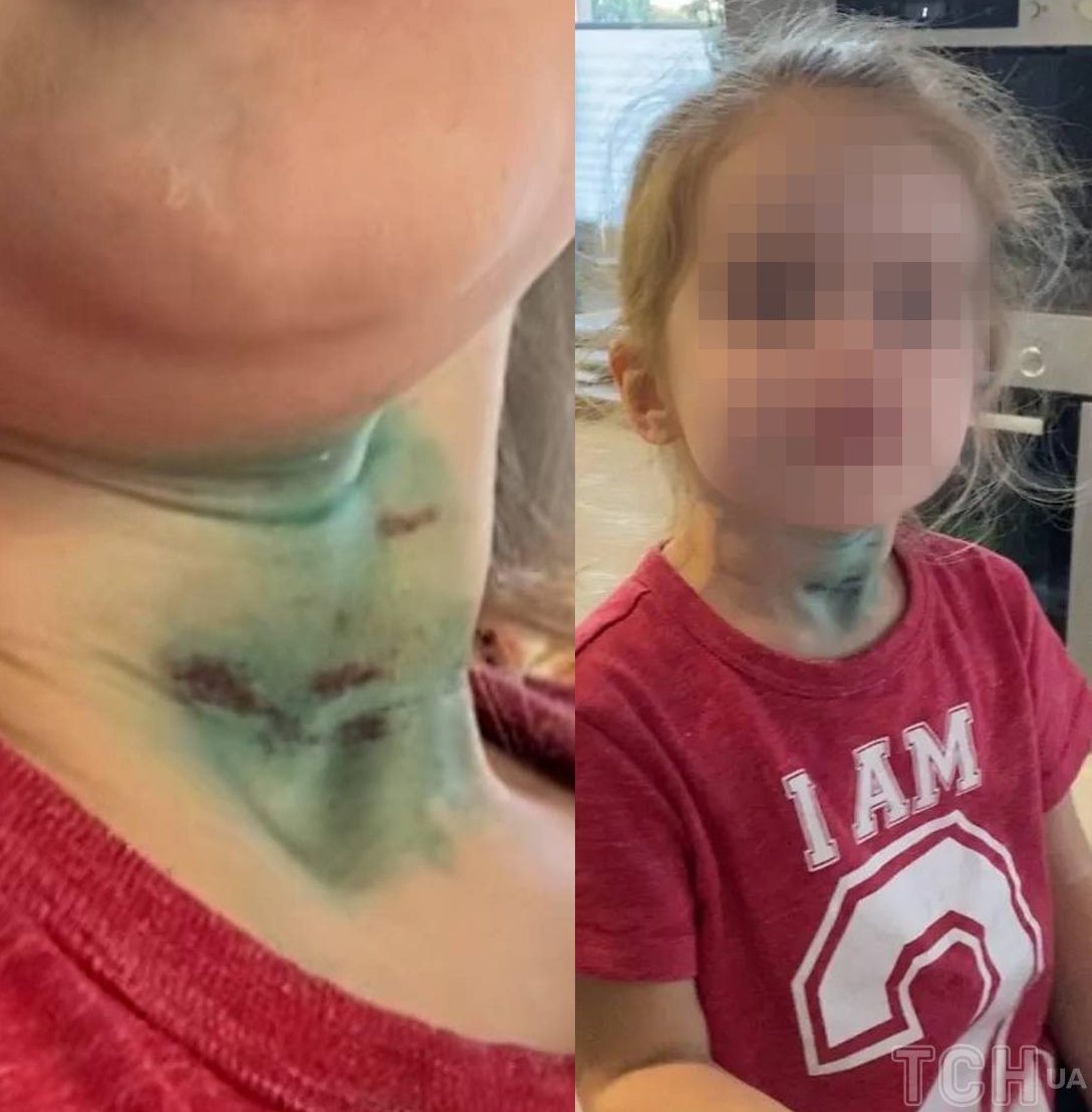 Отец попросил девочку рассказать, что произошло в садике и снял это на видео.