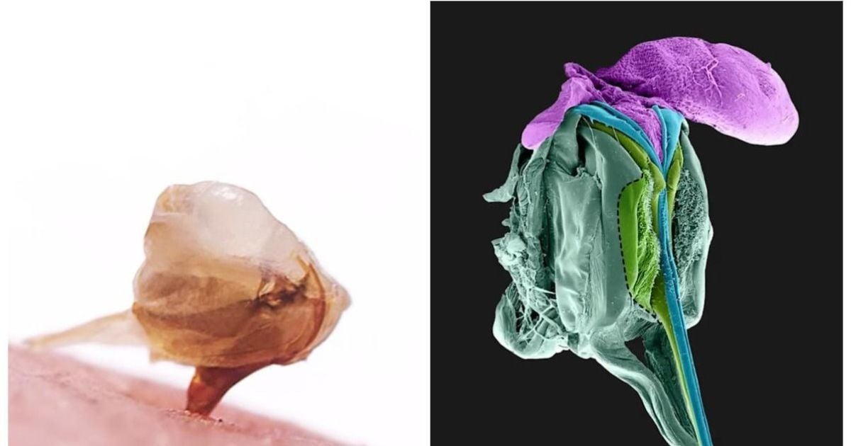 Укус бджоли