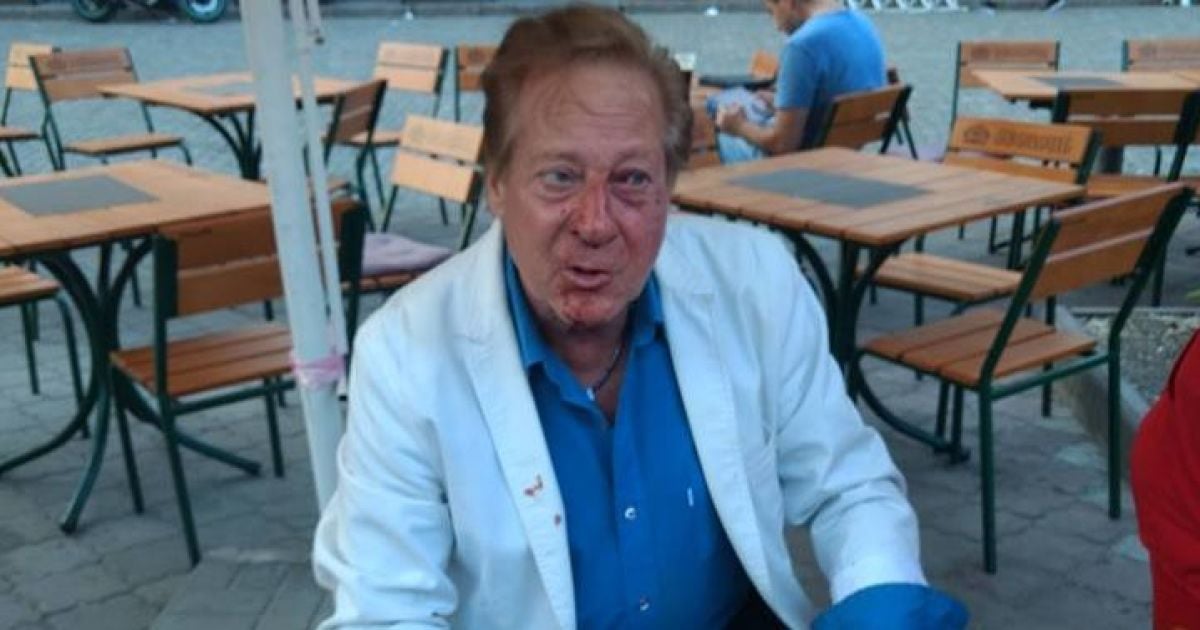 В центре Одессы избили известного американского певца и ученика Фрэнка Синатры