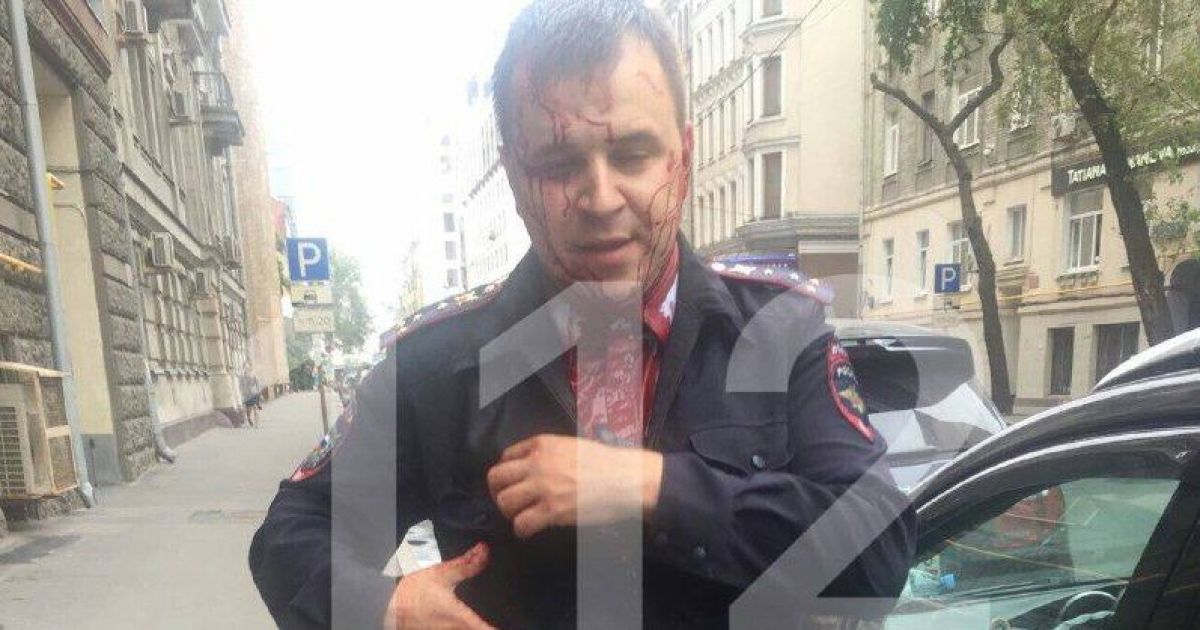 У Москві біля посольства Словаччини чоловік з ножем напав на поліцейського