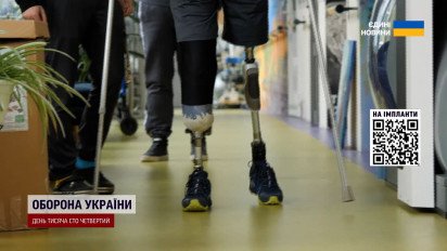Остеоінтеграція: остання надія для тих, кому традиційне протезування не підходить