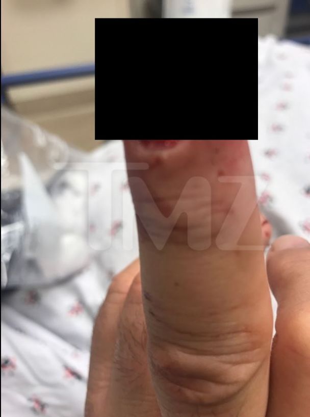 В больницу раненый добрался сам / © tmz.com