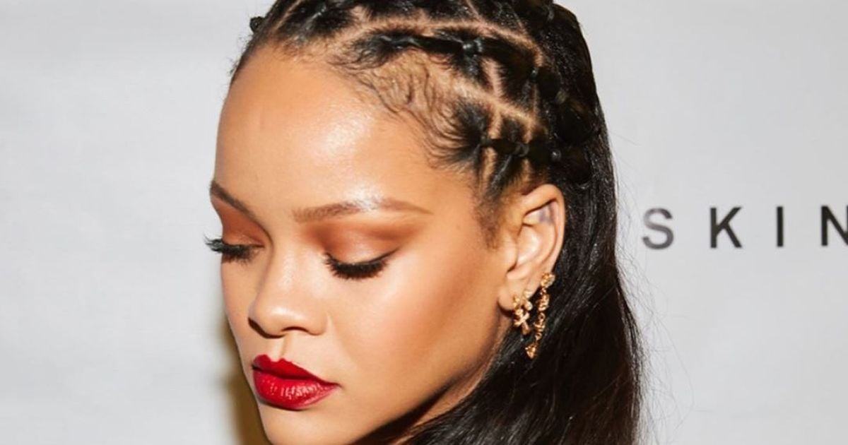 Ріанна занепокоїла фанів синцями та саднами на обличчі