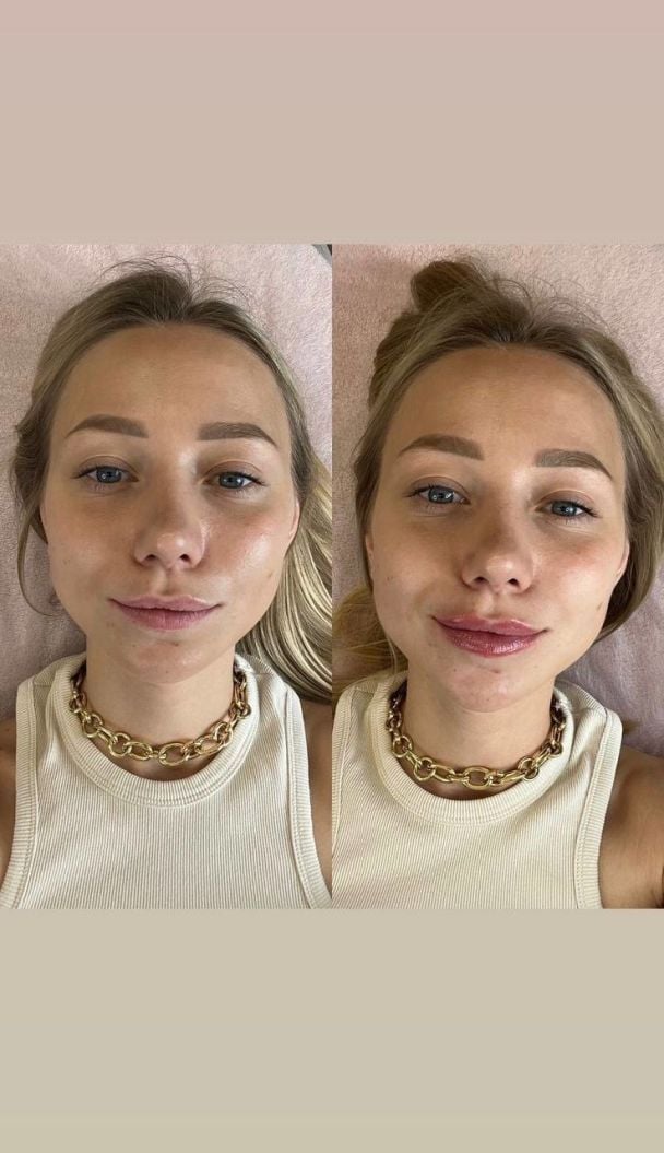 Екатерина Репяхова / © instagram.com/repyahovakate