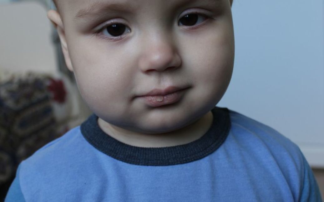 Маленький Егор нуждается в помощи / © ТСН.ua