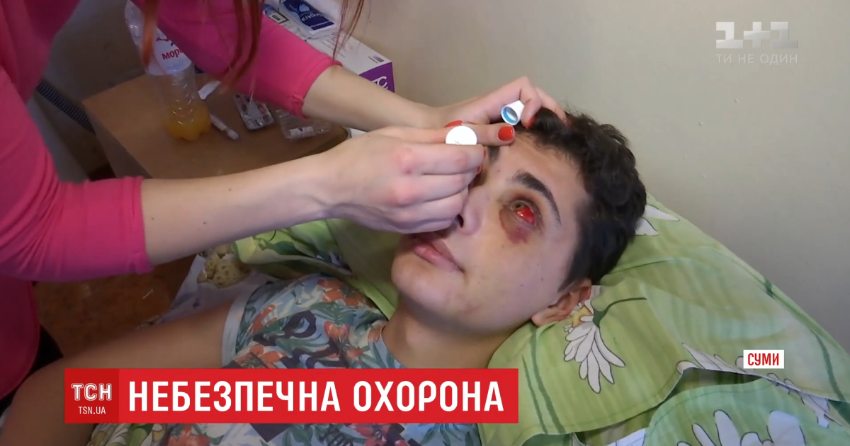 Избитый студент Павел Иванов