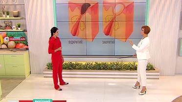 Как побороть черные точки на лице - советы эксперта