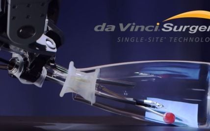 Первый в Украине робот-хирург Da Vinci провел операции в Виннице