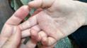 Фахівці очікують спалаху кору не тільки в Києві, але й по всій країні