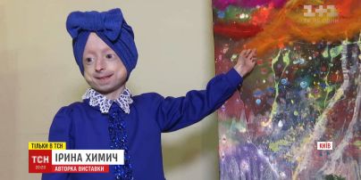 Дівчинка з унікальною хворобою малює картини, аби зібрати кошти собі на лікування