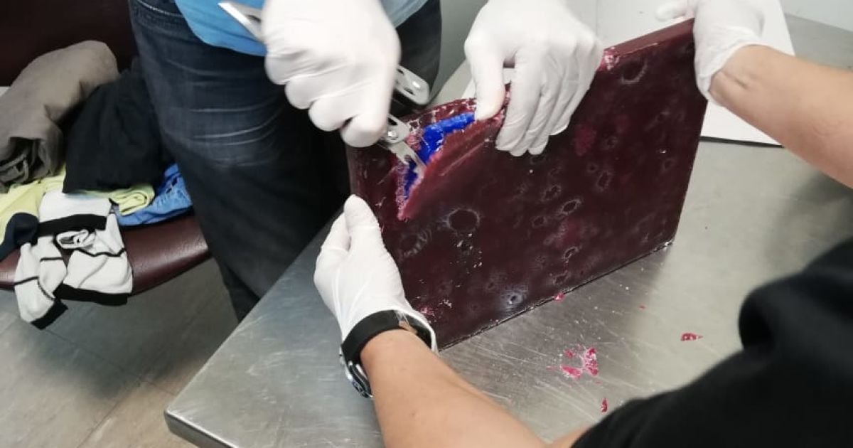 Кокаїн у кишківнику, Бориспіль_2 / © МВД