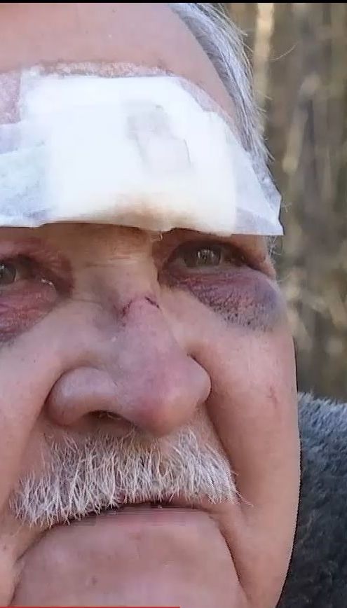 Злоумышленники ворвались в дом и избили экс-полковника милиции на Киевщине
