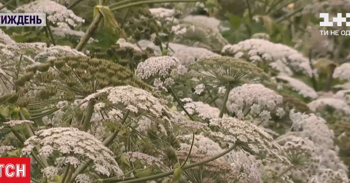 Глубокие поражения, как от пожара: почему следует остерегаться борщевика, сок которого опаснее укуса гадюки