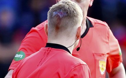 В Шотландии футбольные фанаты разбили голову судьи прямо во время матча