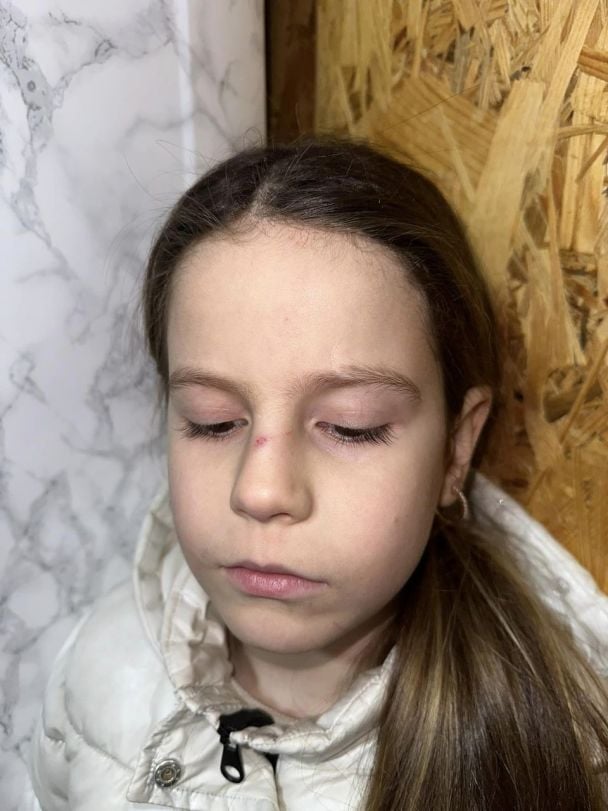 Ребенок, потерпевший черех избиения женщины Фото/Facebook: Иваночка Ванджурак / © 