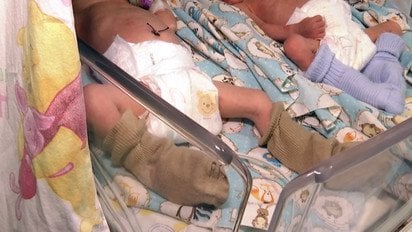 Народила двох синів з різницю у три дні! Неймовірний випадок у Рівному!
