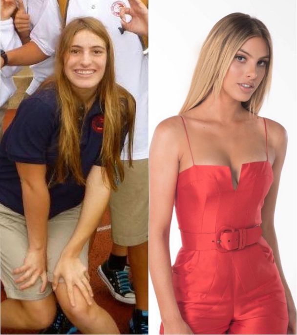 Леле Понс до и после пластики / © instagram.com/lelepons