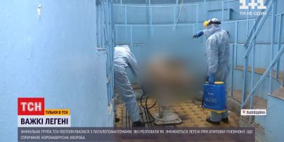 Нагадують печінку: патологоанатоми показали, як коронавірус змінює легені