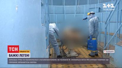 Нагадують печінку: патологоанатоми показали, як коронавірус змінює легені